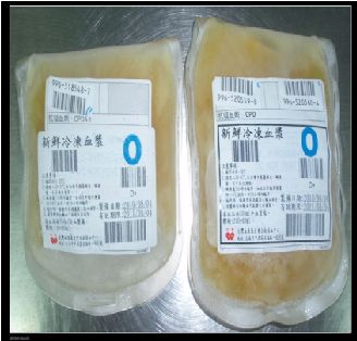 速凍血漿 速凍血漿