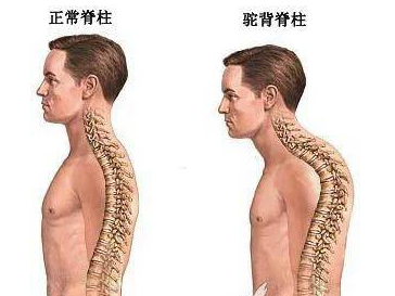 脊柱健康的重要性 脊柱健康的重要性